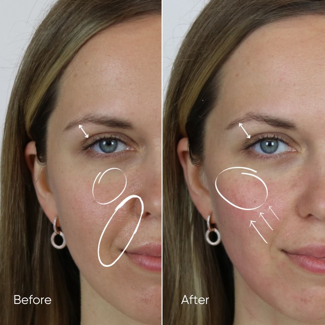 Zemits HydroVerstand PRO 7-in-1 HydroDiamond™ -järjestelmä