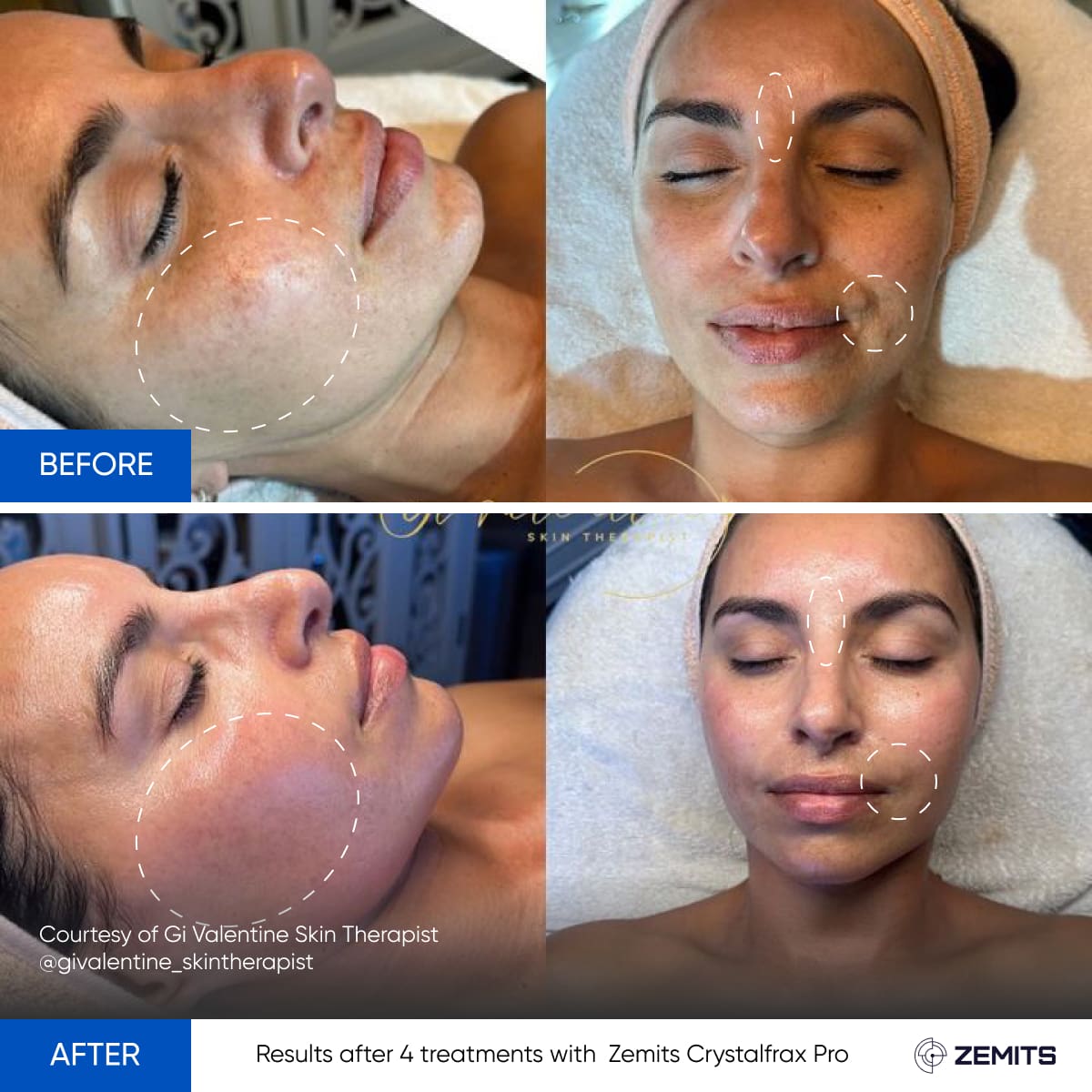 Before After Slide 6