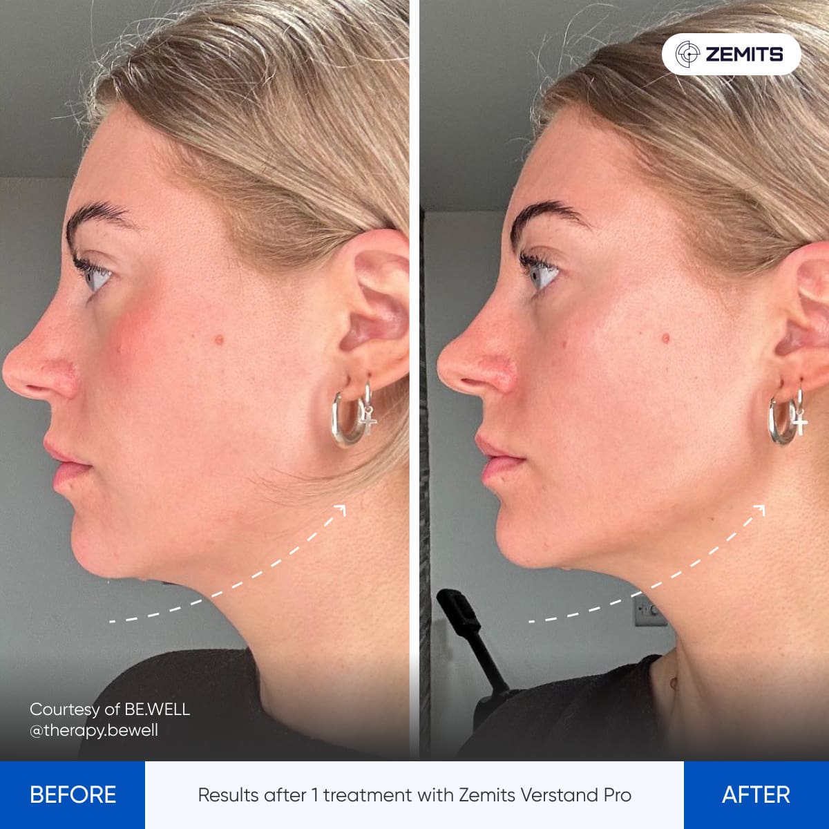 Before After Slide 3