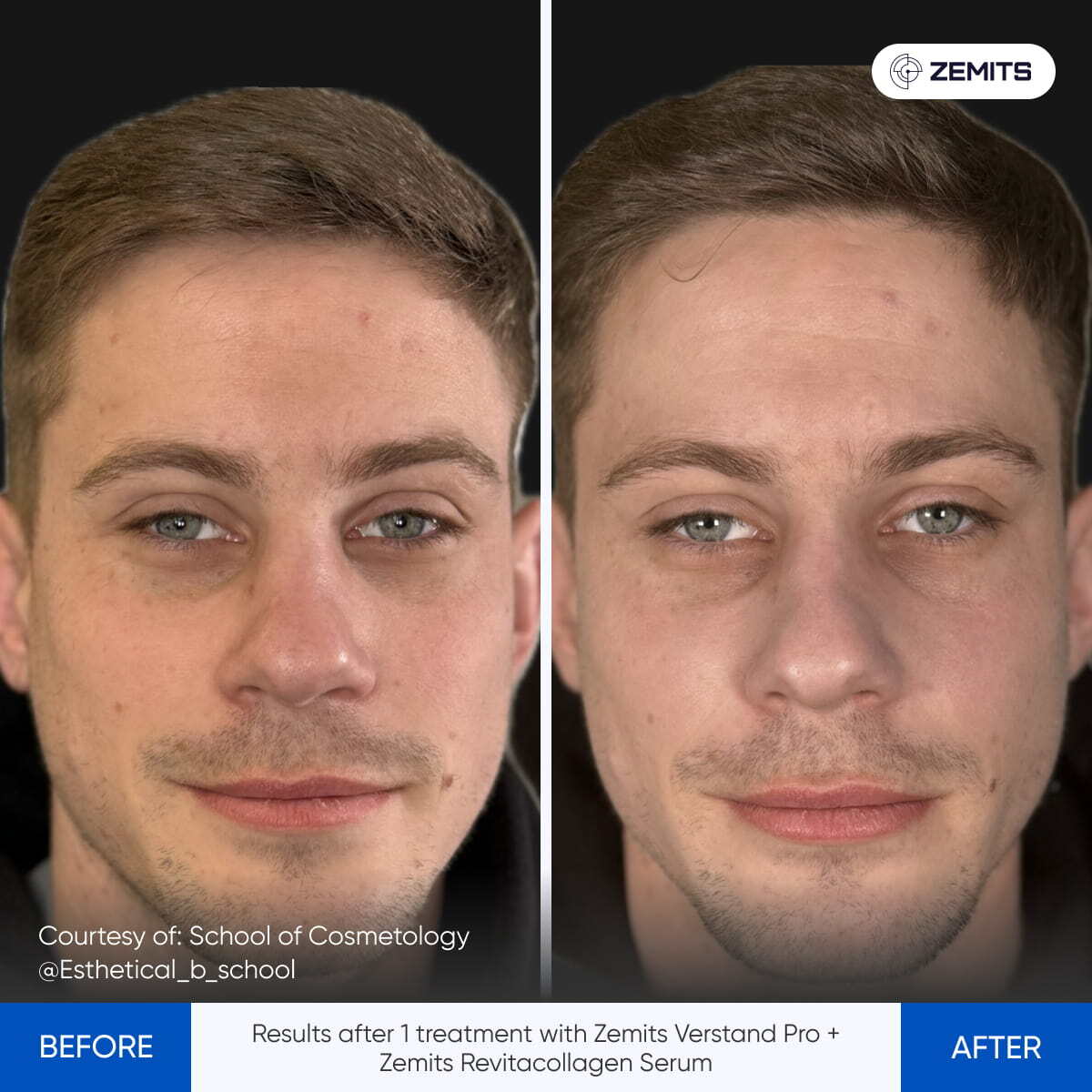 Before After Slide 8
