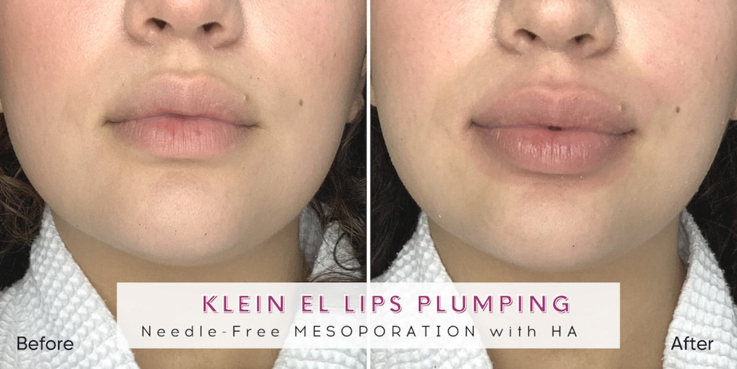 Zemits Klein EL Elektroporaatiojärjestelmä