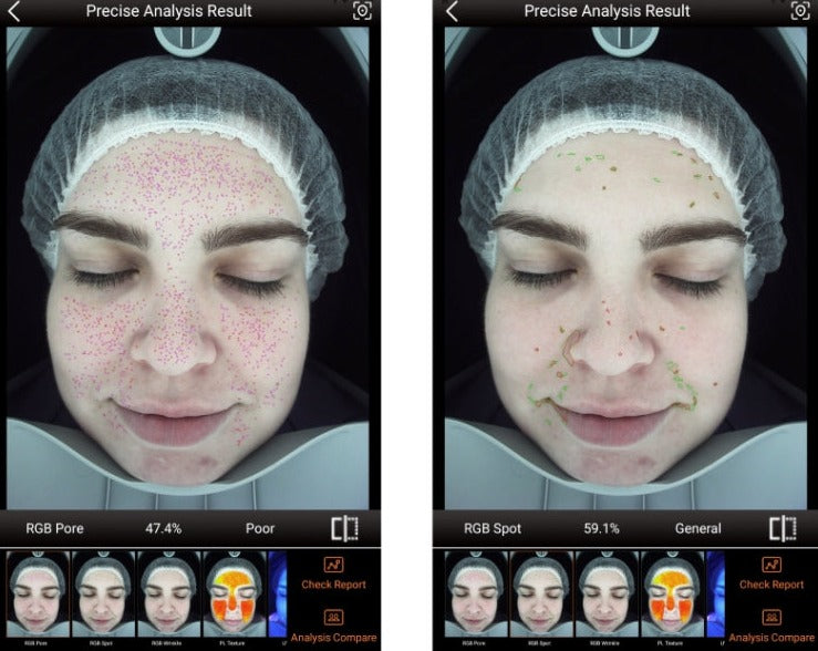 Zemits VeraFace Ihon analysointijärjestelmä