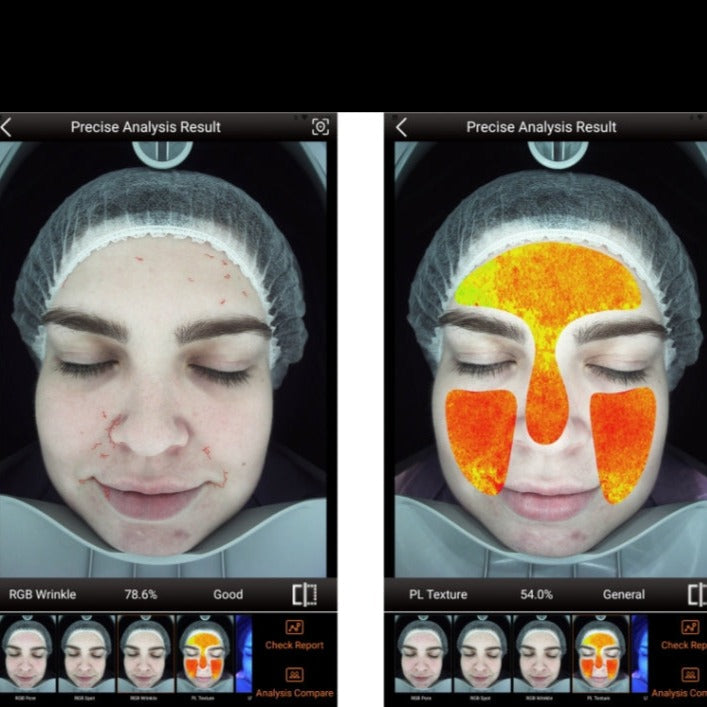 Zemits VeraFace Ihon analysointijärjestelmä